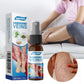 South Moon Varicose Veins Treatment Spray