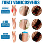 South Moon Varicose Veins Treatment Spray